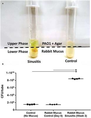 Contribution of Short Chain Fatty Acids to the Growth of Pseudomonas aeruginosa in Rhinosinusitis